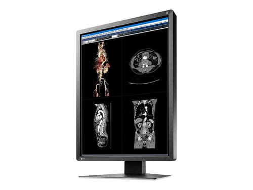 Eizo Radiforce Mx216-sb 21" 1200x1600 Ips 3:4, Musta 1200 X 1600